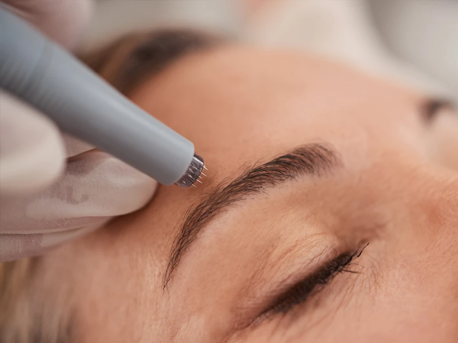 Medical needling Medical needling